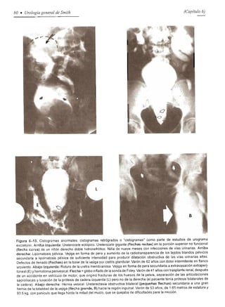 Urologia smith 11_ed