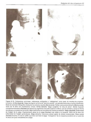 Urologia smith 11_ed