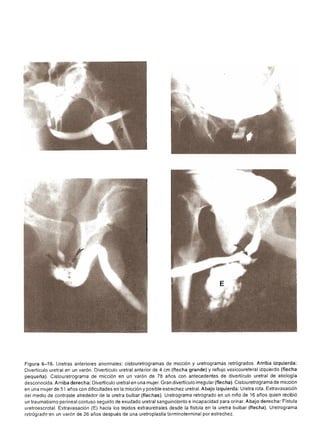 Urologia smith 11_ed