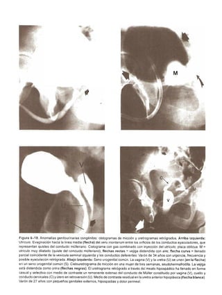 Urologia smith 11_ed