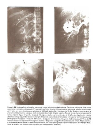 Urologia smith 11_ed