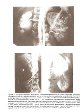Urologia smith 11_ed