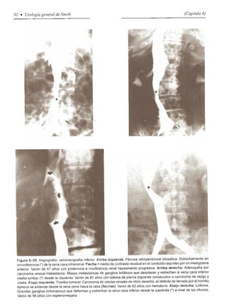 Urologia smith 11_ed