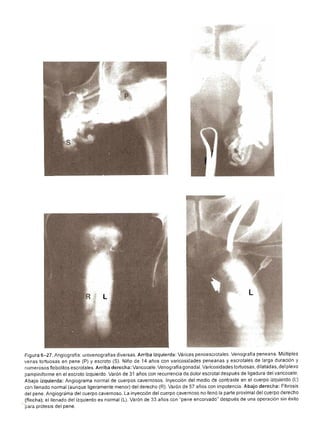 Urologia smith 11_ed