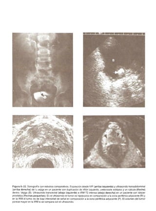 Urologia smith 11_ed