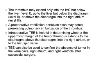  The thrombus may extend only into the IVC but below
the liver (level I), up to the liver but below the diaphragm
(level II), or above the diaphragm into the right atrium
(level III).
 A preoperative ventilation-perfusion scan may detect
preexisting pulmonary embolization of the thrombus.
 Intraoperative TEE is helpful in determining whether the
uppermost margin of the tumor thrombus extends to the
diaphragm, above the diaphragm, into the right atrium, or
to the tricuspid valve.
 TEE can also be used to confirm the absence of tumor in
the vena cava, right atrium, and right ventricle after
successful surgery.
 