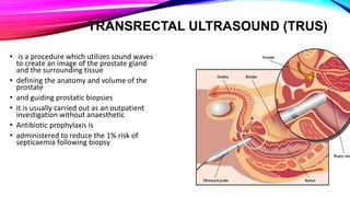 Trus Urology Example Urological investigations | PPTX