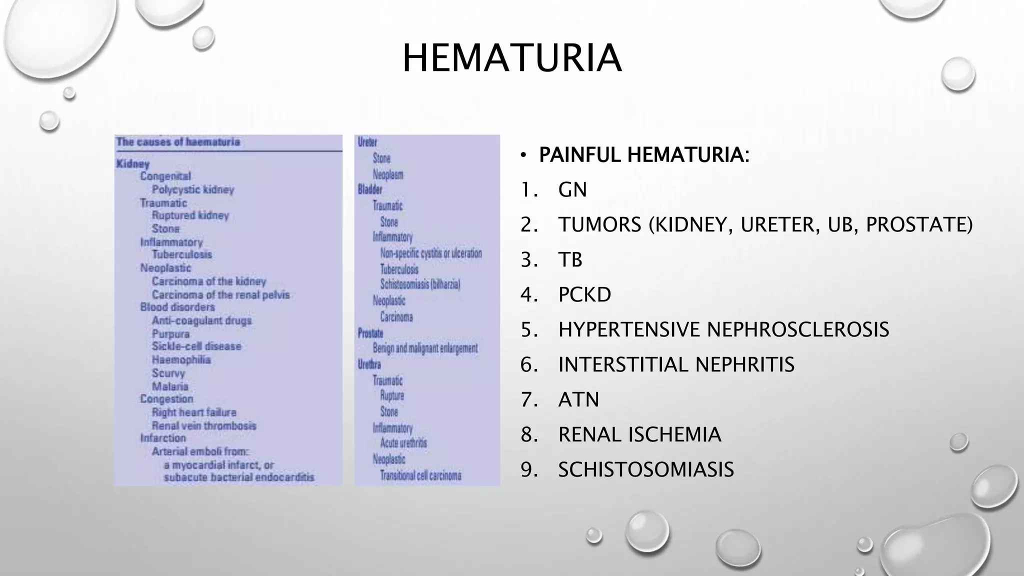 HEMATURIA
• PAINFUL HEMATURIA:
1. GN
2. TUMORS (KIDNEY, URETER, UB, PROSTATE)
3. TB
4. PCKD
5. HYPERTENSIVE NEPHROSCLEROSIS
6. INTERSTITIAL NEPHRITIS
7. ATN
8. RENAL ISCHEMIA
9. SCHISTOSOMIASIS
 