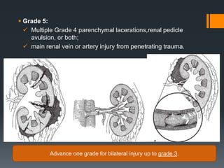 Urological emergencies | PPTX