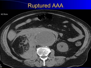 Urological emergencies | PPT
