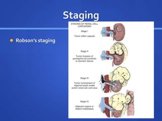 Staging
 Robson’s staging
 
