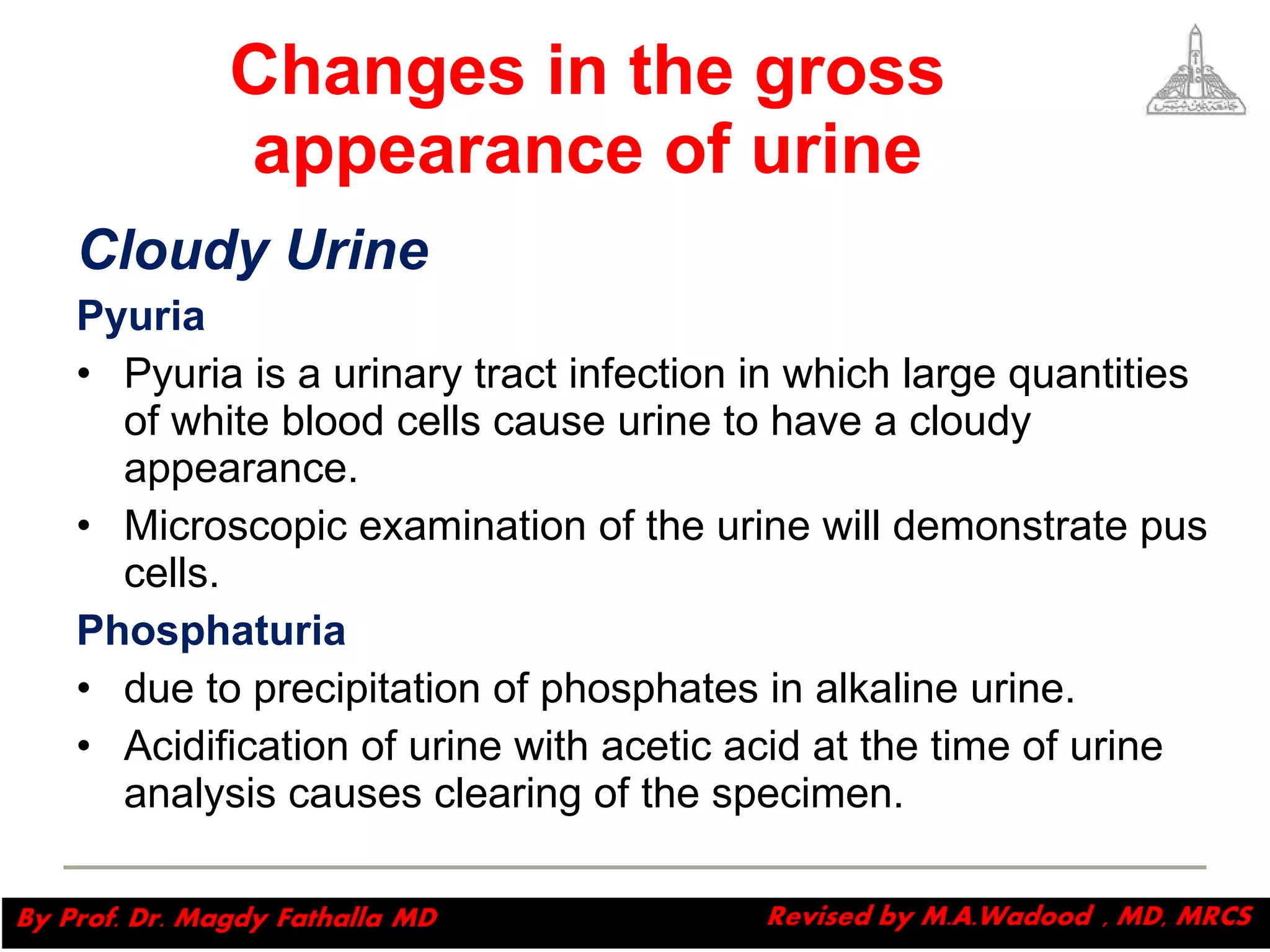 Changes in the gross appearance of urine Cloudy Urine Pyuria   Pyuria is a urinary tract infection in which large quantities of white blood cells cause urine to have a cloudy appearance.  Microscopic examination of the urine will demonstrate pus cells. Phosphaturia   due to precipitation of phosphates in alkaline urine.  Acidification of urine with acetic acid at the time of urine analysis causes clearing of the specimen. Magdy Fath-Alla, 2009 