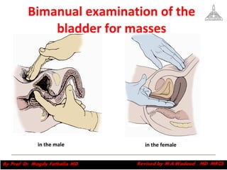 Bimanual examination of the bladder for masses in the male in the female 