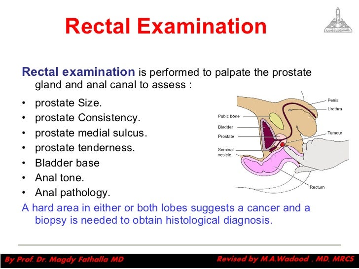 Urologic symptoms and examination