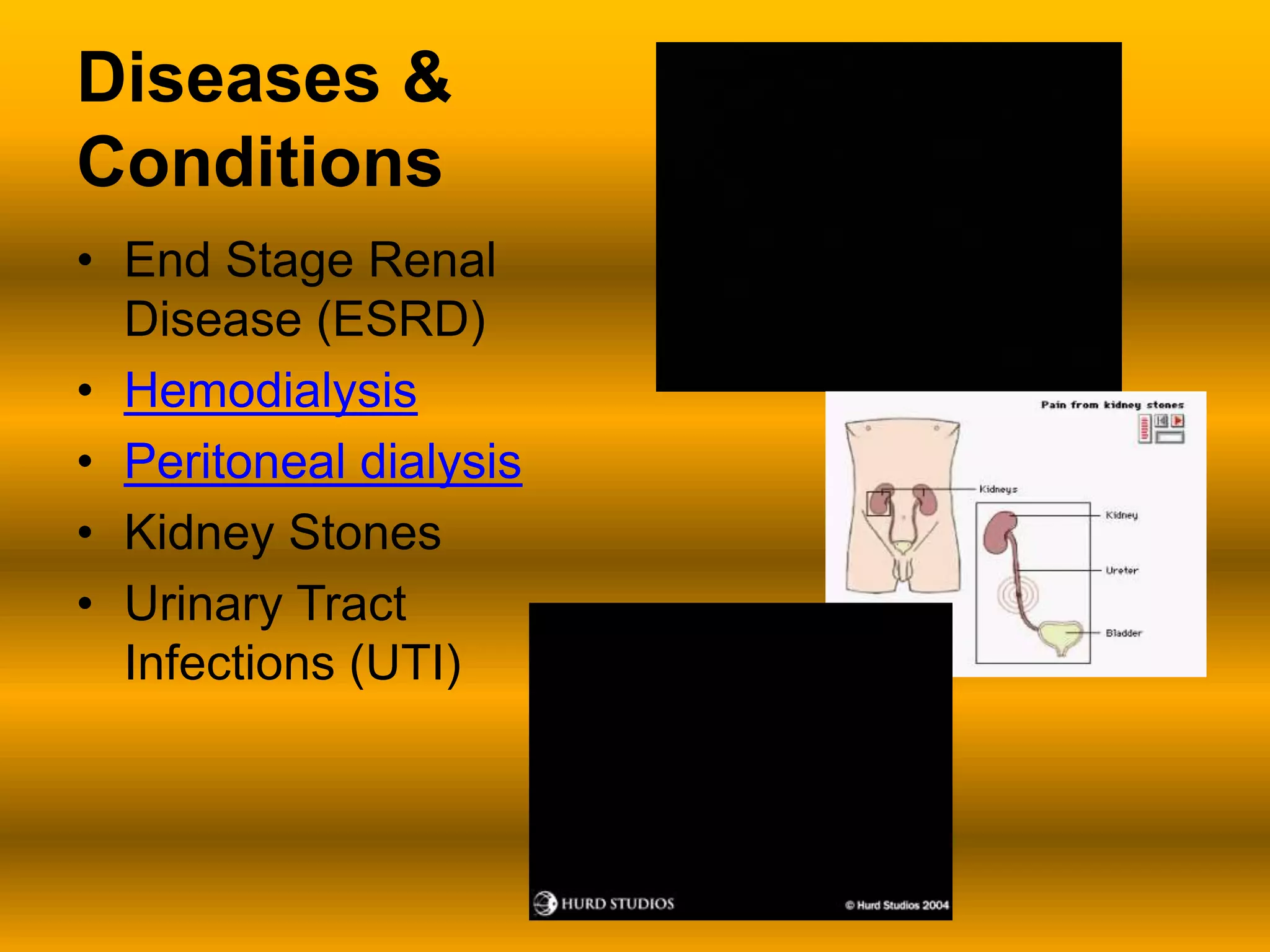 Diseases & ConditionsEnd Stage Renal Disease (ESRD)HemodialysisPeritoneal dialysisKidney StonesUrinary Tract Infections (UTI)