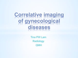 Correlative imaging
of gynecological
diseases
Tina PW Lam
Radiology
QMH

 