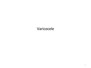 Varicocele
1
 