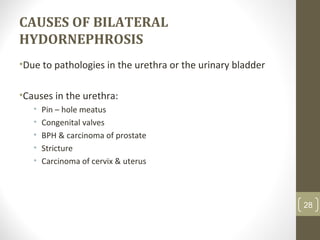 CAUSES OF BILATERAL
HYDORNEPHROSIS
•Due to pathologies in the urethra or the urinary bladder
•Causes in the urethra:
• Pin – hole meatus
• Congenital valves
• BPH & carcinoma of prostate
• Stricture
• Carcinoma of cervix & uterus
28
 