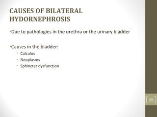 CAUSES OF BILATERAL
HYDORNEPHROSIS
•Due to pathologies in the urethra or the urinary bladder
•Causes in the bladder:
• Calculus
• Neoplasms
• Sphincter dysfunction
29
 