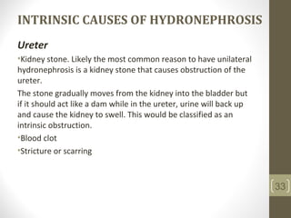 INTRINSIC CAUSES OF HYDRONEPHROSIS
Ureter
•Kidney stone. Likely the most common reason to have unilateral
hydronephrosis is a kidney stone that causes obstruction of the
ureter.
The stone gradually moves from the kidney into the bladder but
if it should act like a dam while in the ureter, urine will back up
and cause the kidney to swell. This would be classified as an
intrinsic obstruction.
•Blood clot
•Stricture or scarring
33
 