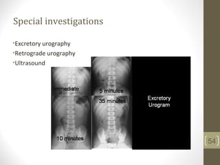 Special investigations
•Excretory urography
•Retrograde urography
•Ultrasound
54
 