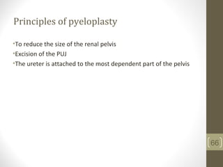 Principles of pyeloplasty
•To reduce the size of the renal pelvis
•Excision of the PUJ
•The ureter is attached to the most dependent part of the pelvis
66
 