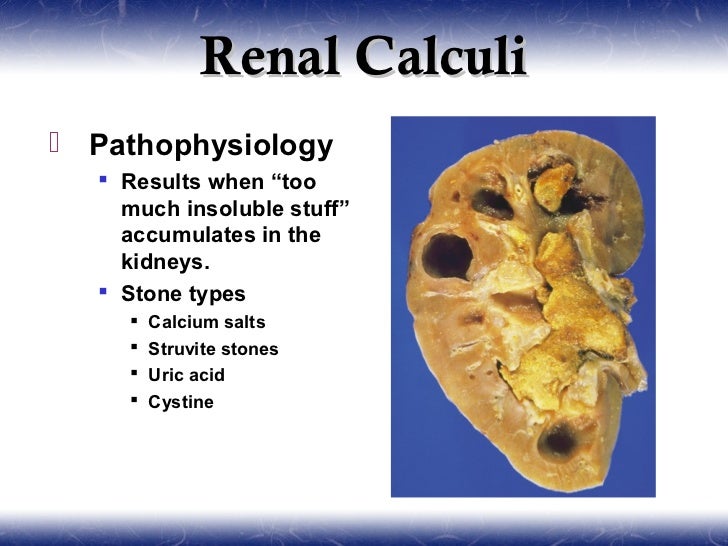 Urology and nephrology