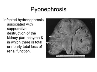 Urology infection [Dr. Edmond Wong] | PPT