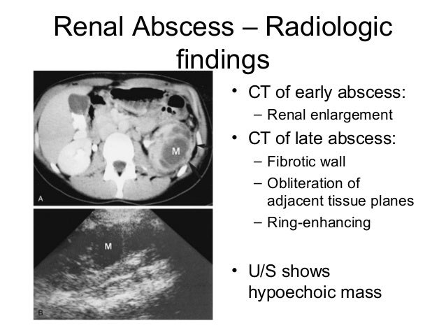 Urology Infection Dr Edmond Wong