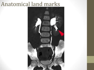 Anatomical land marks

 