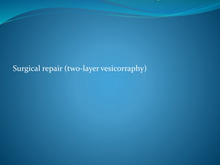 Surgical repair (two-layer vesicorraphy)
 