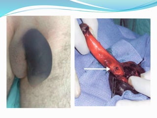 urology trauma english.pptx