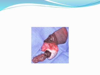 urology trauma english.pptx