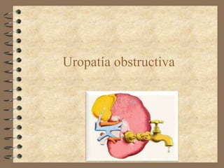 Uropatía obstructiva
 