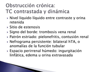  Nivel liquido líquido entre contraste y orina
retenida
 Sitio de estenosis
 Signo del borde: trombosis vena renal
 Patrón estriado: pielonefritis, contusión renal
 Nefrograma persistente: bilateral hTA, o
anomalías de la función tubular
 Espacio perirrenal húmedo: ingurgitación
linfática, edema u orina extravasada
 