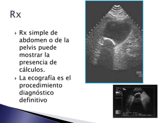  Rx simple de
abdomen o de la
pelvis puede
mostrar la
presencia de
cálculos.
 La ecografía es el
procedimiento
diagnóstico
definitivo
 