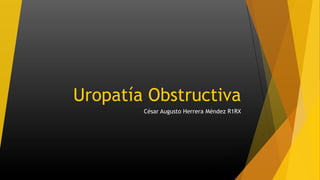 Uropatía Obstructiva
César Augusto Herrera Méndez R1RX
 