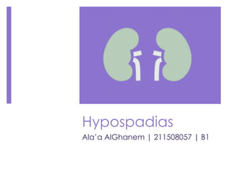 Hypospadias
Ala’a AlGhanem | 211508057 | B1
 