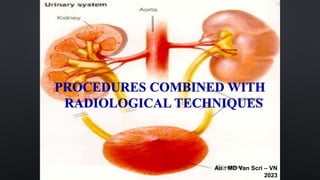 PROCEDURES COMBINED WITH
RADIOLOGICAL TECHNIQUES
Au.: MD Van Scri – VN
2023
 