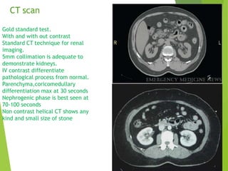 URORADIOLOGY , Investigations in Urology | PPTX