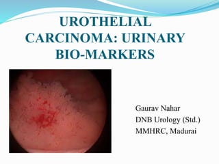 UROTHELIAL
CARCINOMA: URINARY
BIO-MARKERS
Gaurav Nahar
DNB Urology (Std.)
MMHRC, Madurai
 