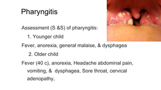Pharyngitis
Assessment (S &S) of pharyngitis:
1. Younger child
Fever, anorexia, general malaise, & dysphagea
2. Older child
Fever (40 c), anorexia, Headache abdominal pain,
vomiting, & dysphagea, Sore throat, cervical
adenopathy,
 