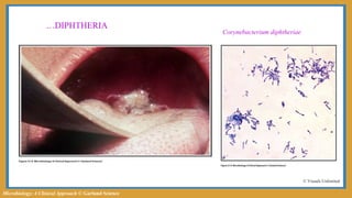 Microbiology: A Clinical Approach © Garland Science
…DIPHTHERIA
© Visuals Unlimited
Corynebacterium diphtheriae
 