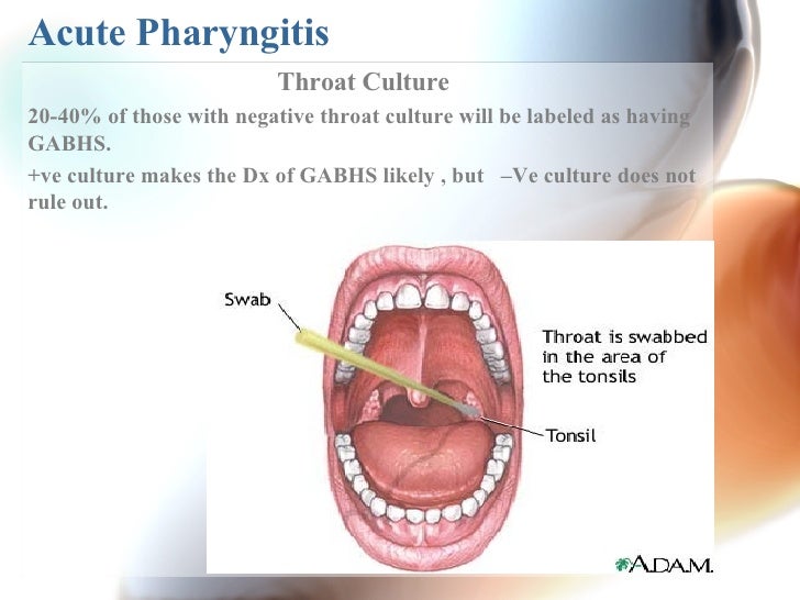 How To Do A Throat Swab 60