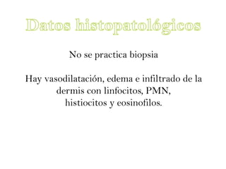 No se practica biopsia

Hay vasodilatación, edema e infiltrado de la
       dermis con linfocitos, PMN,
         histiocitos y eosinofilos.
 