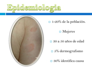    1-20% de la población.

              Mujeres

       30 a 50 años de edad

       5% dermografismo

       30% identifica causa
 