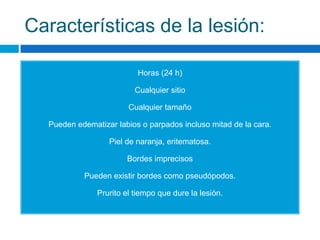 Características de la lesión:

                          Horas (24 h)

                          Cualquier sitio

                        Cualquier tamaño

  Pueden edematizar labios o parpados incluso mitad de la cara.

                  Piel de naranja, eritematosa.

                       Bordes imprecisos

           Pueden existir bordes como pseudópodos.

               Prurito el tiempo que dure la lesión.
 
