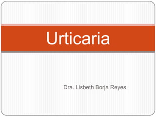 Urticaria

  Dra. Lisbeth Borja Reyes
 