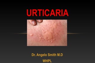 Dr. Angelo Smith M.D
WHPL
URTICARIA
 