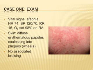 Urticaria | PPTX
